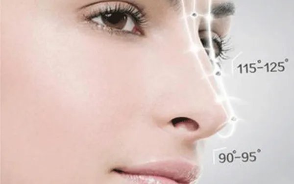 注射瑞蓝玻尿酸隆鼻价格是多少