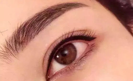 开眼角整形要多少钱