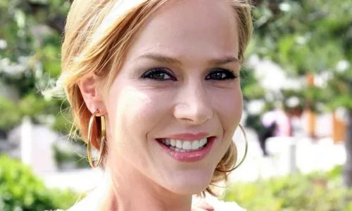 抬头纹可以去除吗