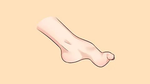 脚趾甲变厚怎么回事
