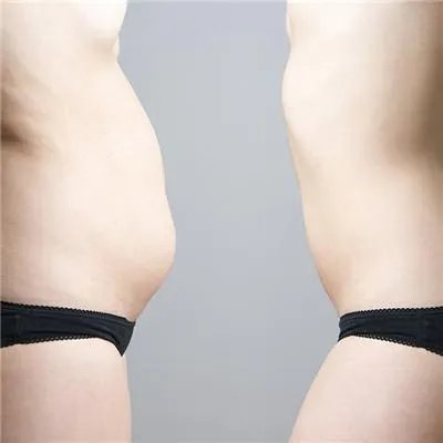 如何减肥效果最快