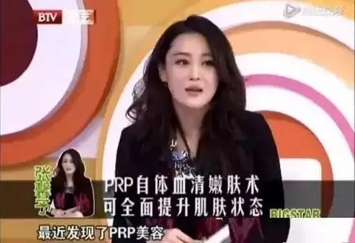 张馨予整容了吗？是演员敬业的体现吗？