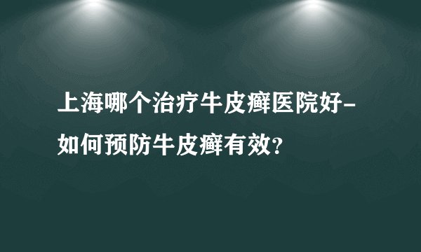 上海哪个治疗牛皮癣医院好-如何预防牛皮癣有效?