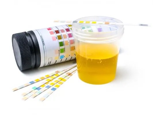 宫外孕用试纸能测出来吗