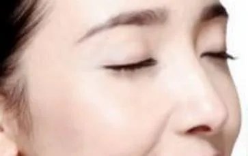 注射瑞兰玻尿酸价格