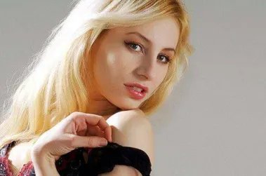 杭州哪家医院发际线植发口碑好