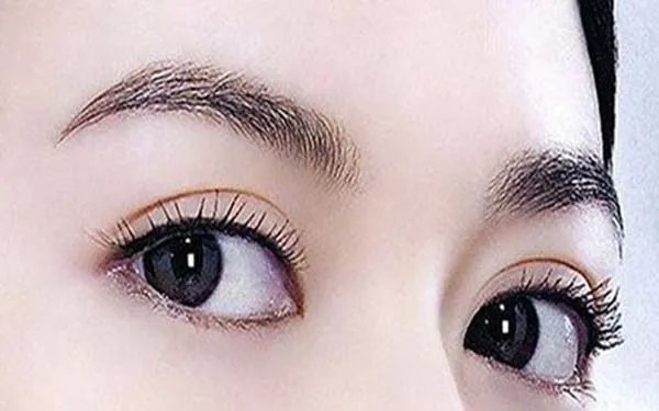 韩式开眼角效果好吗