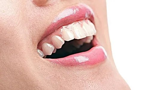 牙齿矫正价格大概多少