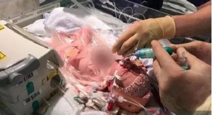 心脏长在体外存活概率有多大？