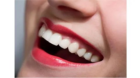 成都牙齿矫正价格