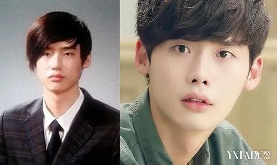 金明洙整容照片曝光韩国男星出道前后对比照