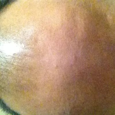 掉头发厉害是什么原因