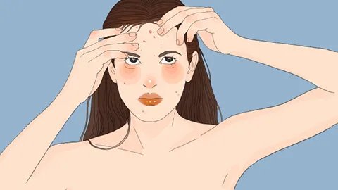 减少青春痘的方法