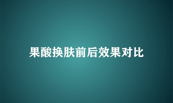 果酸换肤前后效果对比
