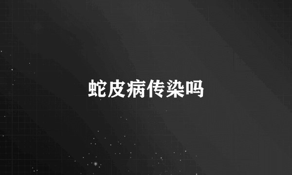 蛇皮病传染吗