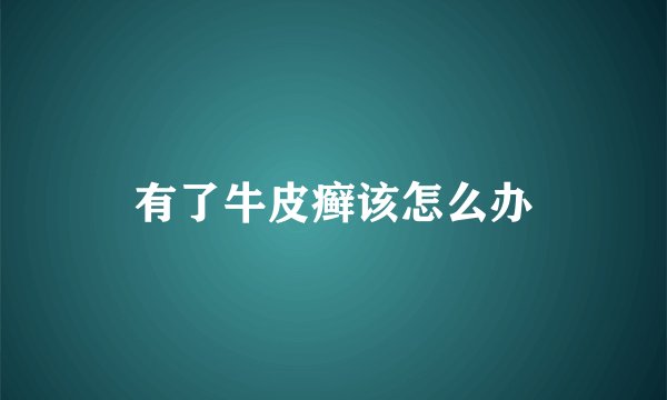 有了牛皮癣该怎么办