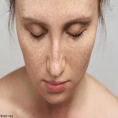 怎么用小苏打祛斑