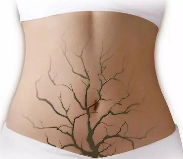 身体出现哪些症状，就说明你该排毒了呢？