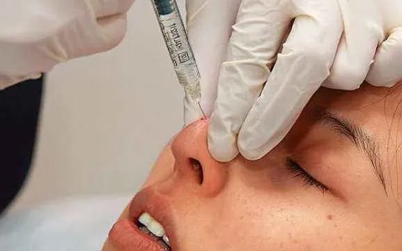 2021长沙艺星医学美容医院隆鼻价格表(价目表)怎么样?