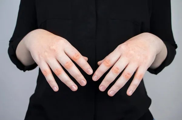 手指尺寸5cm是多少