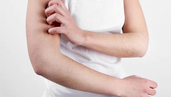 皮肤过敏了怎么办