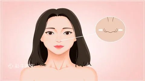 酒糟鼻怎样能治好