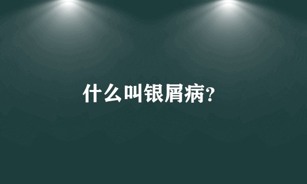 什么叫银屑病?