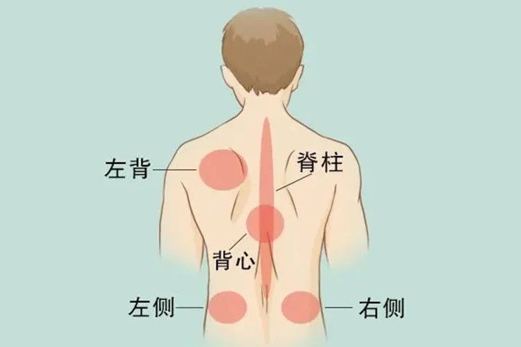 后背疼痛分布图疼痛的鉴别