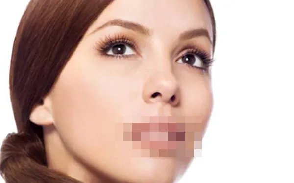 丰脸颊需要多少钱呢