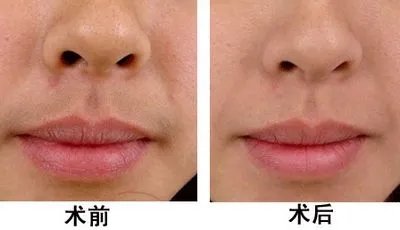 2021西安艺星医疗美容医院脱毛价格表(价目表)怎么样?