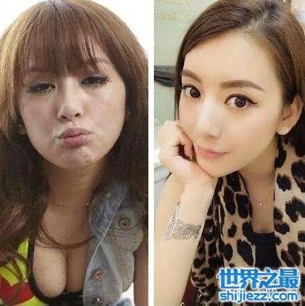 方媛整容前后对比，整容前照片曝光(就是一路人甲) 