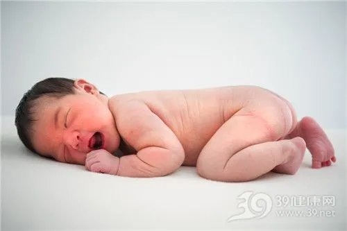 新生儿湿疹的误区有哪些