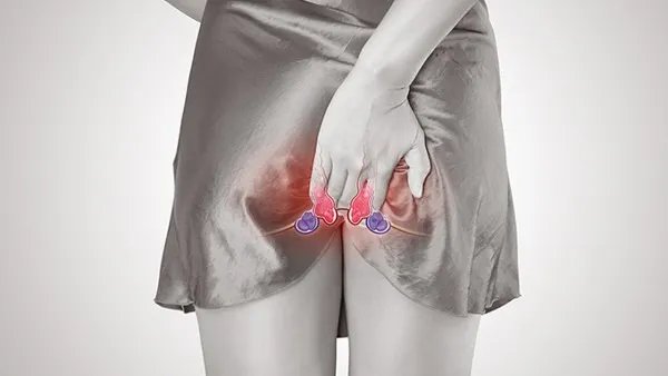 痔疮的危害有什么