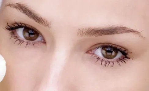 去鱼尾纹手术多少钱