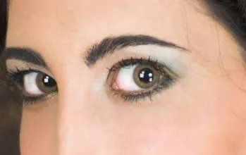 压双眼皮有什么副作用