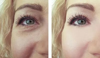 怎样可以美白淡斑