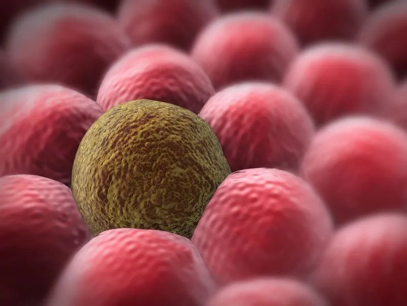 如果有这4个特征，可能是“癌症免疫体”，哪怕一个也要恭喜你