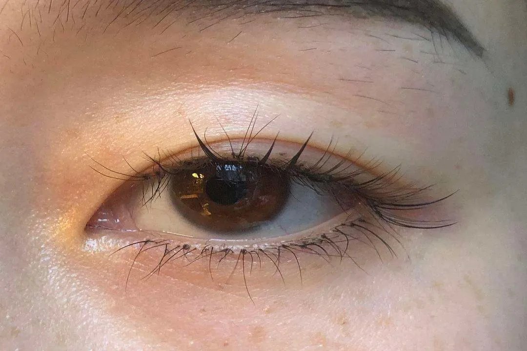 正常人眼睛图片