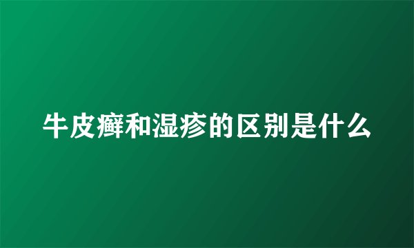 牛皮癣和湿疹的区别是什么