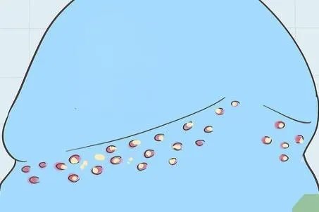 龟头感染霉菌症状图片