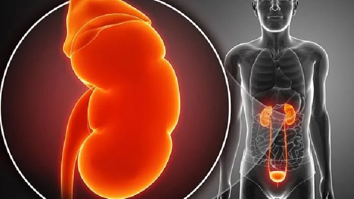 iga肾炎会带来哪些危害