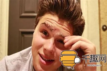 男子往脸上涂乳胶漆撕下奇迹出现（组图）