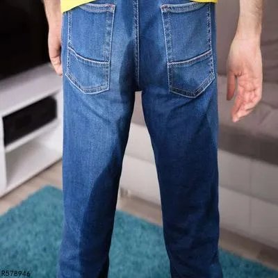 狼疮肾炎注意些什么