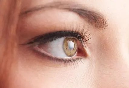 广州哪家医院开内眼角好