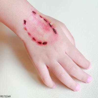 猫抓了没出血要不要打疫苗 什么情况下要打狂犬疫苗