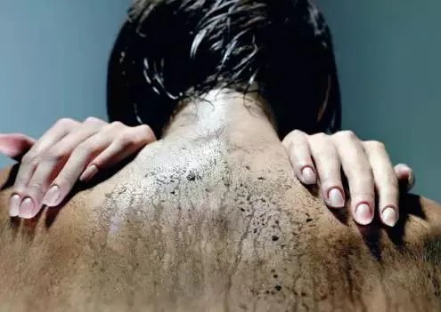 身体出现哪些症状，就说明你该排毒了呢？