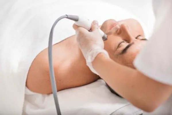 皮脂腺痣激光治疗 皮脂腺痣激光治疗的注意事项