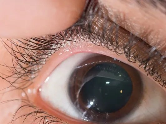 什么颜色对眼睛好