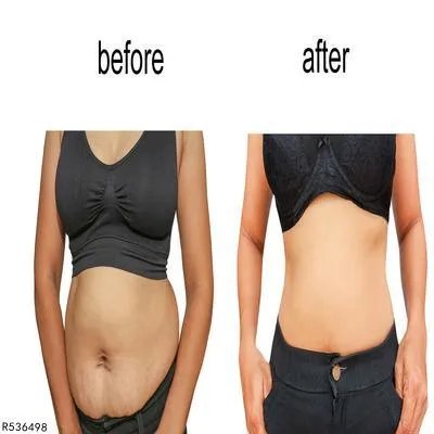 索丽可减肥胶囊怎么样