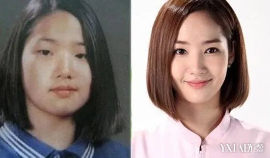 朴敏英进军中国整容前后对比照片曝光被指差别大